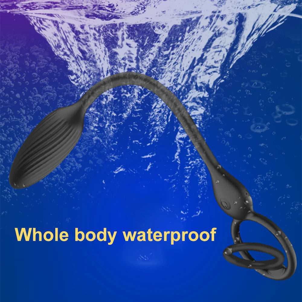 Inferno Grip β Dual-Ring Prostate Tease Plug π₯ππ₯