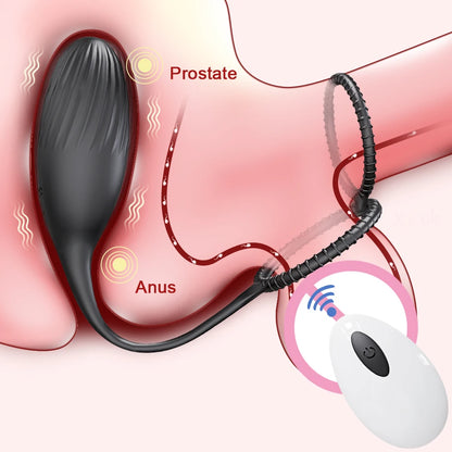 Black Orbit – Remote-Controlled Anal Ring & Vibe  💫🔥🖤
