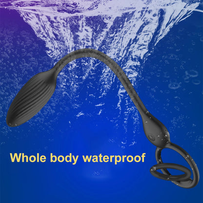 Inferno Grip – Dual-Ring Prostate Tease Plug 🔥🍑💥